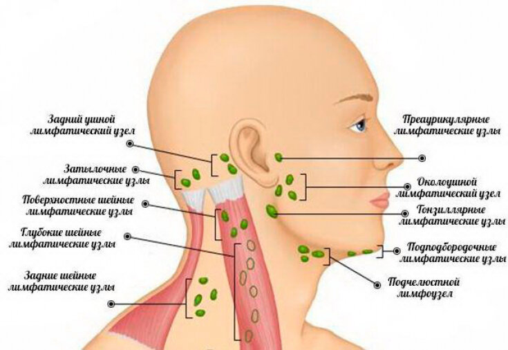 Увеличенные лимфатические узлы на шее: причины и симптомы | esculab