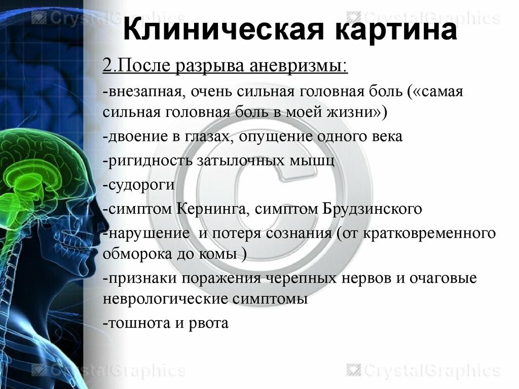 Презентация аневризмы сосудов головного мозга