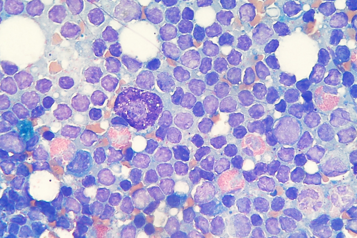 Рисунок 1 - Микроскопическая фотография тучных клеток