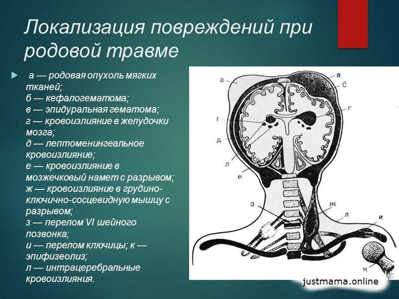 Осложненные роды, какие бывают?