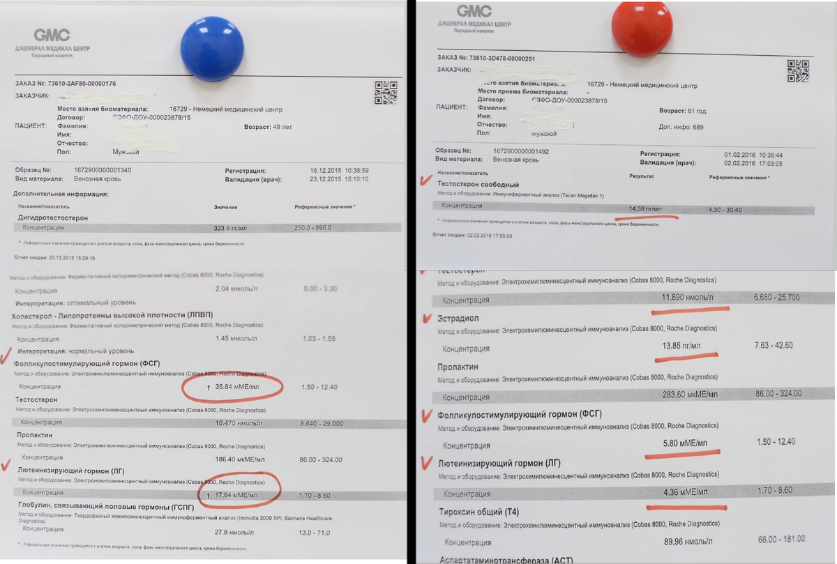 Справа анализы 61-летнего натурала, который живёт в кайф, слева - 49-летний химик с диагнозом вторичный гипогонадизм с необратимыми последствиями и невозможностью иметь детей. Как говорится, найди 10 отличий (простите за чёрный юмор).