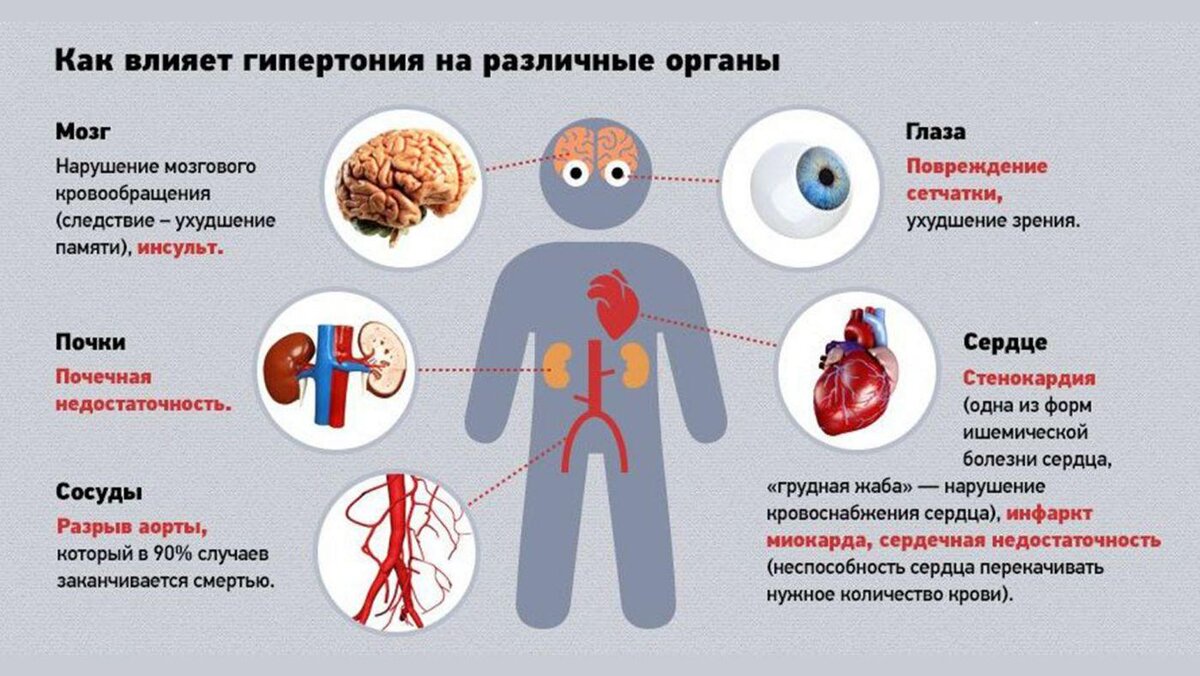 3 сердечно-сосудистых заболевания, о которых нужно знать всем | Evolutis  Clinic | Дзен