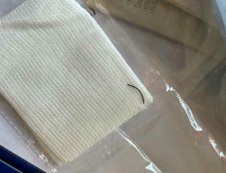    Оренбургские офтальмологи извлекли из глаза подростка железную стружку длиной 2 см Белов Михаил Александрович