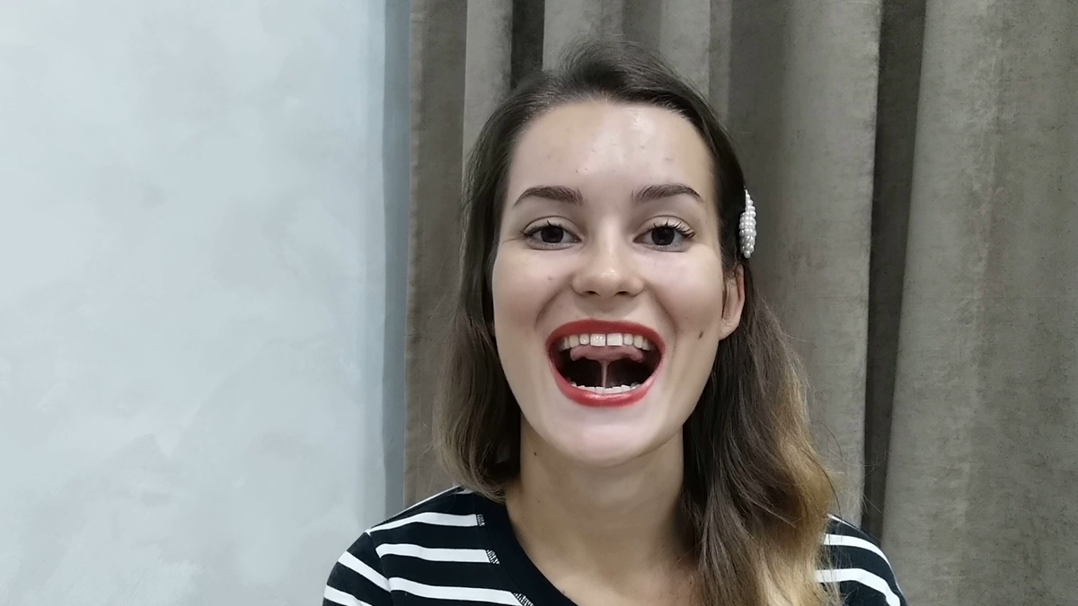 Открываем рот и удерживанием язык в положении упражнения"Грибок"