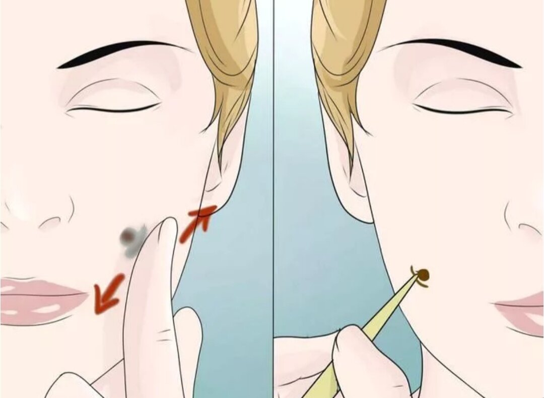 Как сделать ямочки на щеках: 4 гениальных бьюти-хака из ТикТока
