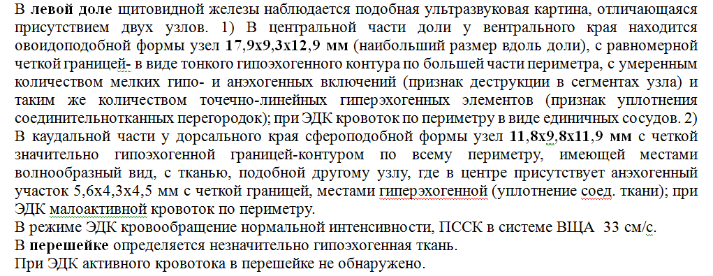 Как формально проводят УЗИ щитовидной или... врач не увидела узел. Случай из практики