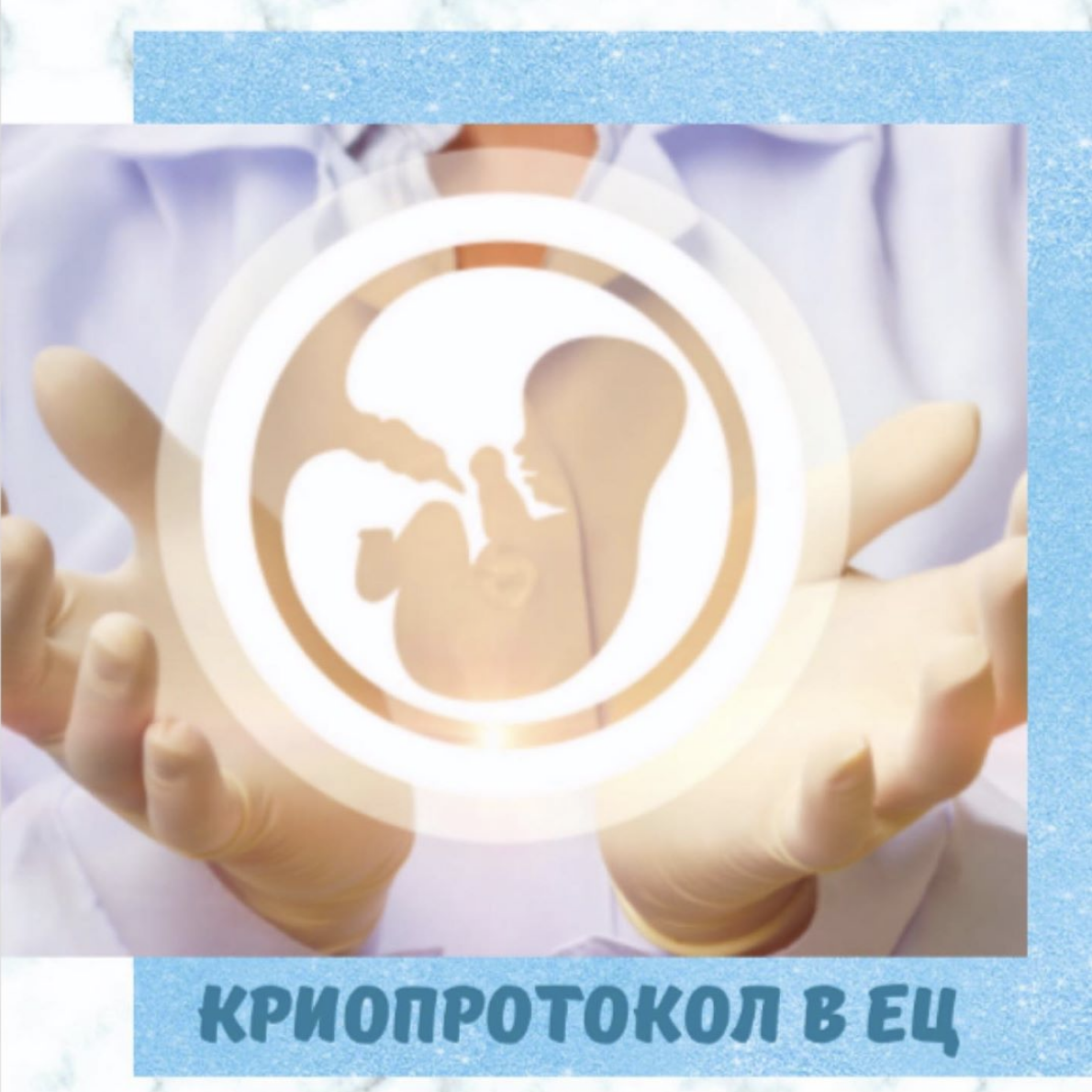 Криопротокол в естественном. Криопротокол. эко в естественном цикле. криопротокол в естественном цикле по дням. криопротокол с блокадой гипофиза.