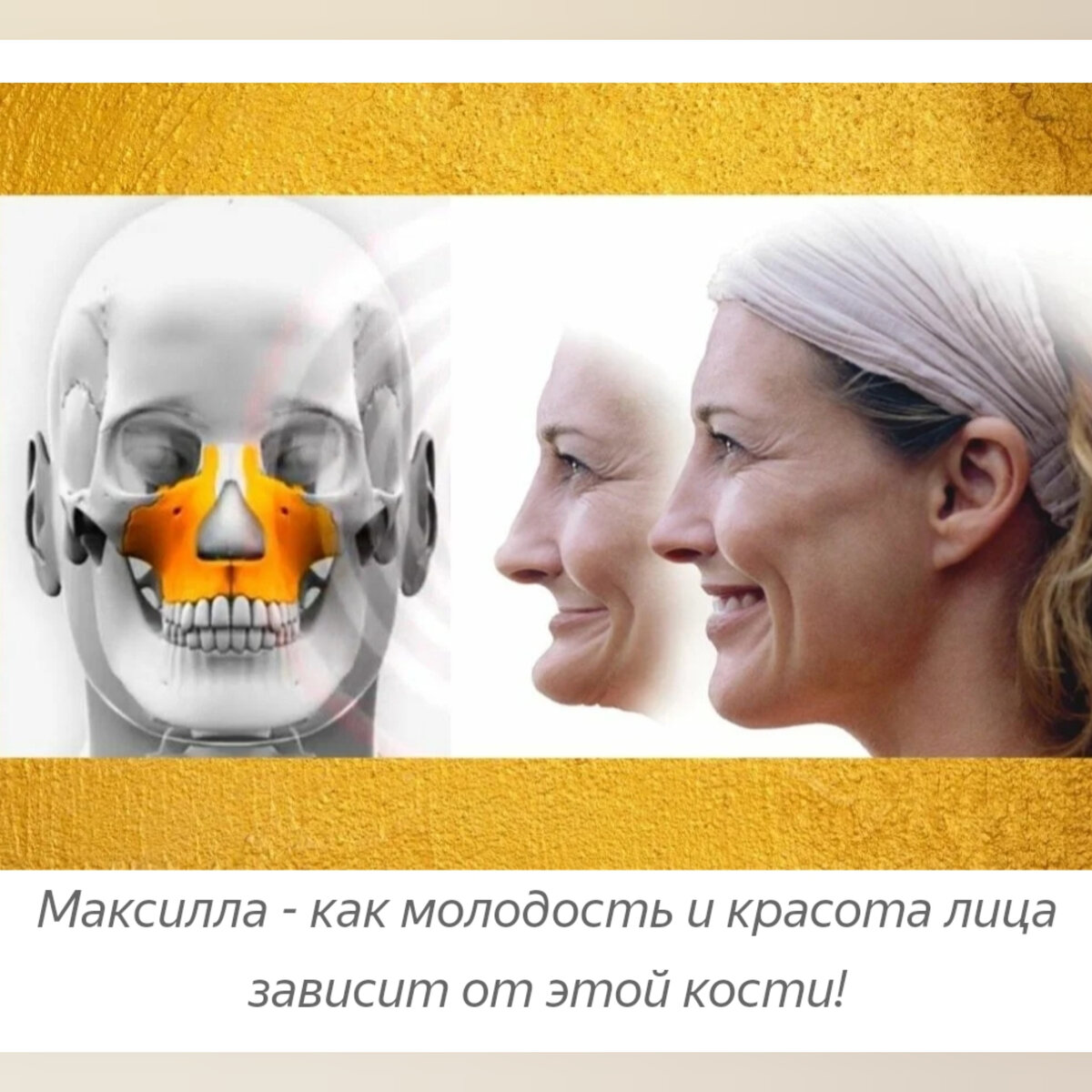 Музыка мьюинга