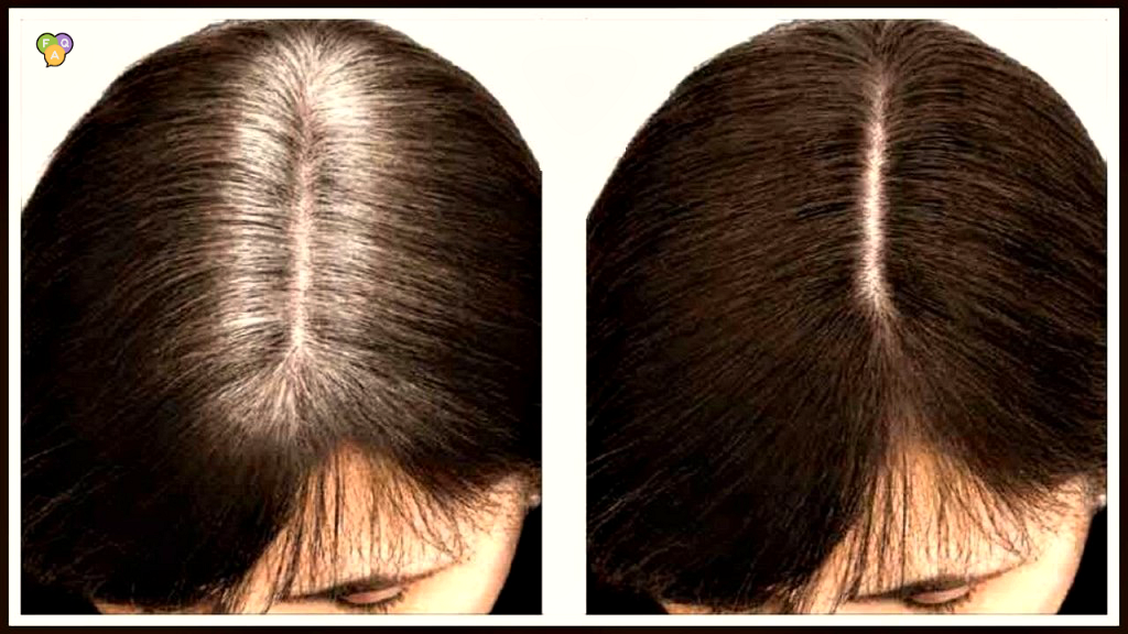 Седина волос