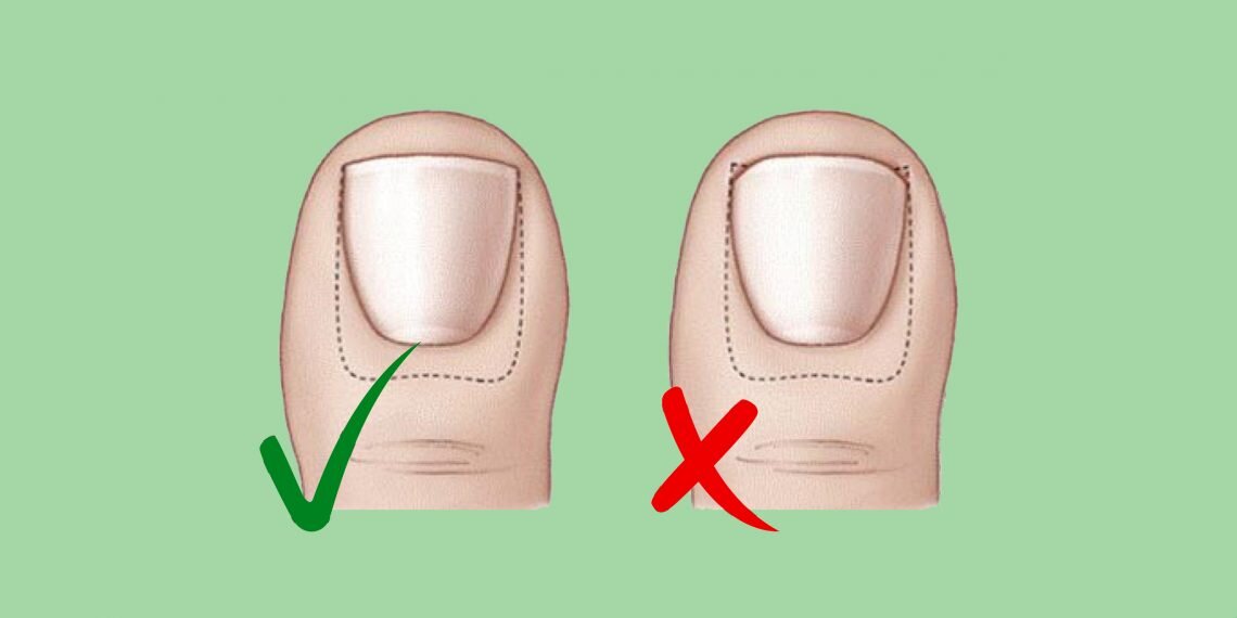 ноготь должен быть квадратной формы