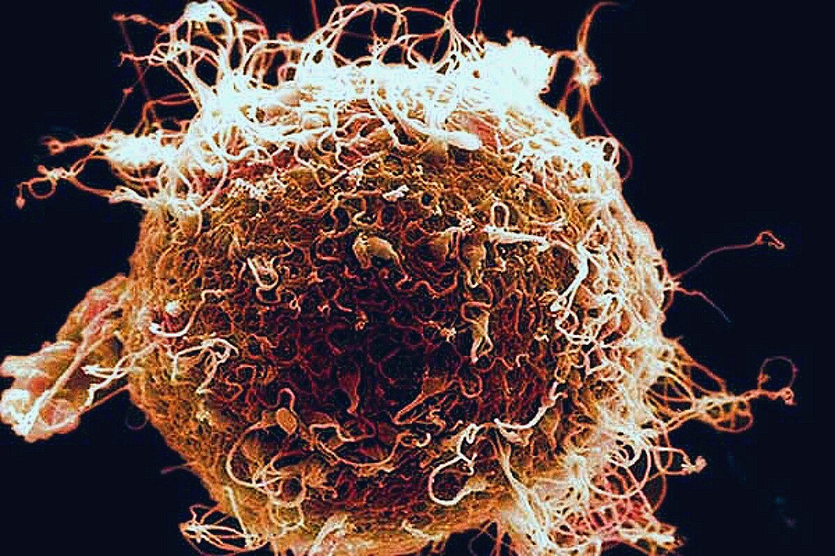 Яйцеклетка, атакуемая сперматозоидами