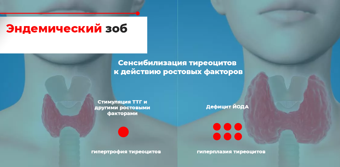 Iodine deficiency thyroid disease in the Russian Federation the current  state of the problem nalytical review of publications and data of  official state statistics Rosstat - Melnichenko - Consilium Medicum