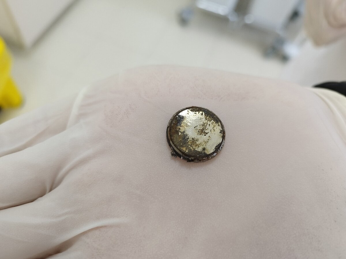    Врачи Нижневартовска спасли годовалого ребенка с батарейкой в пищеводе