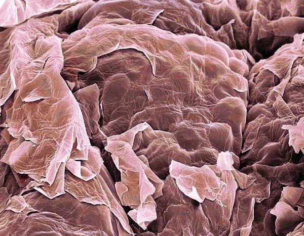 Поверхность кожи человека под микроскопом