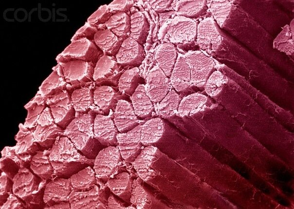                                         это мышечные волокна после тренировки 