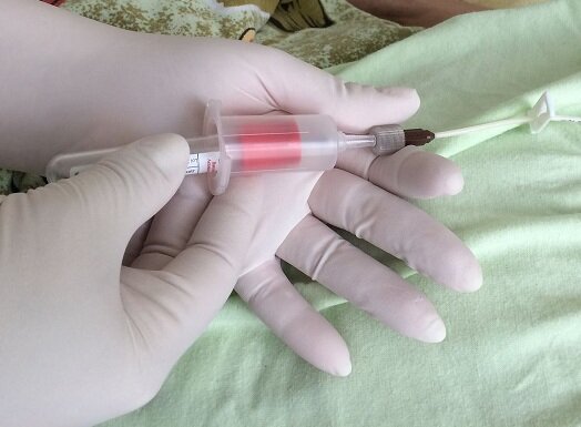 Взятие крови из катетера