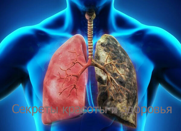 Источник: Гугл Картинки