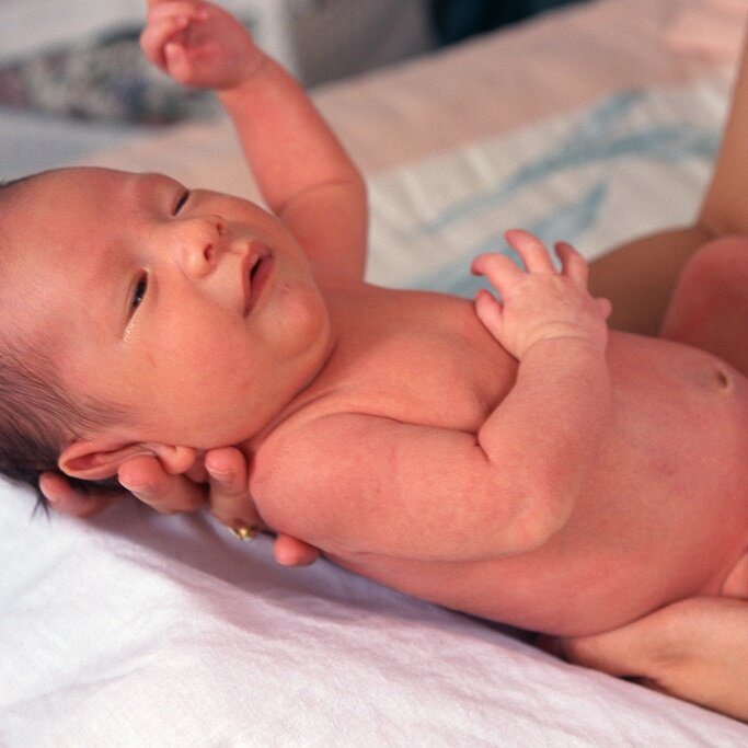 Акне новорожденных: причины, симптомы, Комаровский видео | У Гиппократа