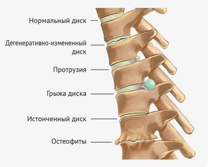 Полезная гимнастика. Упражнения для здоровья позвоночника.