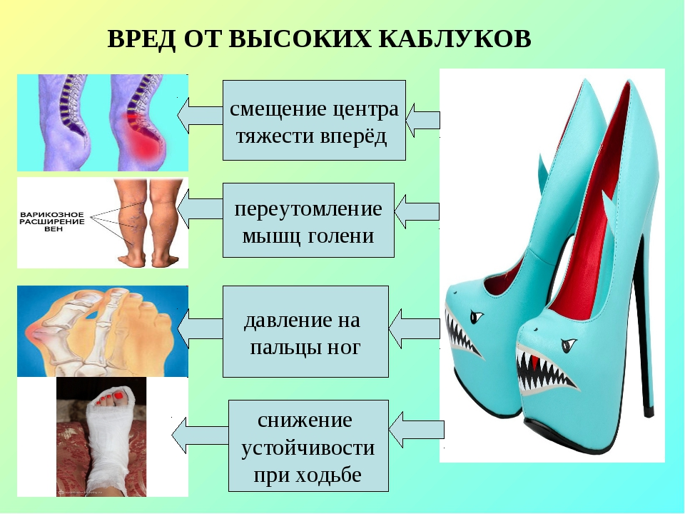 Как избежать проблем со стопами?