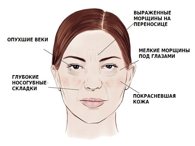 Ухудшение лимфатической системы
