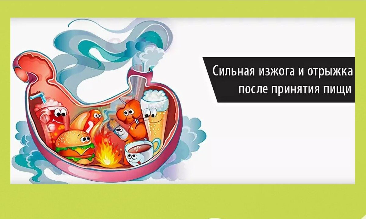Постоянная отрыжка воздухом после еды: причины и лечение в клинике СПб
