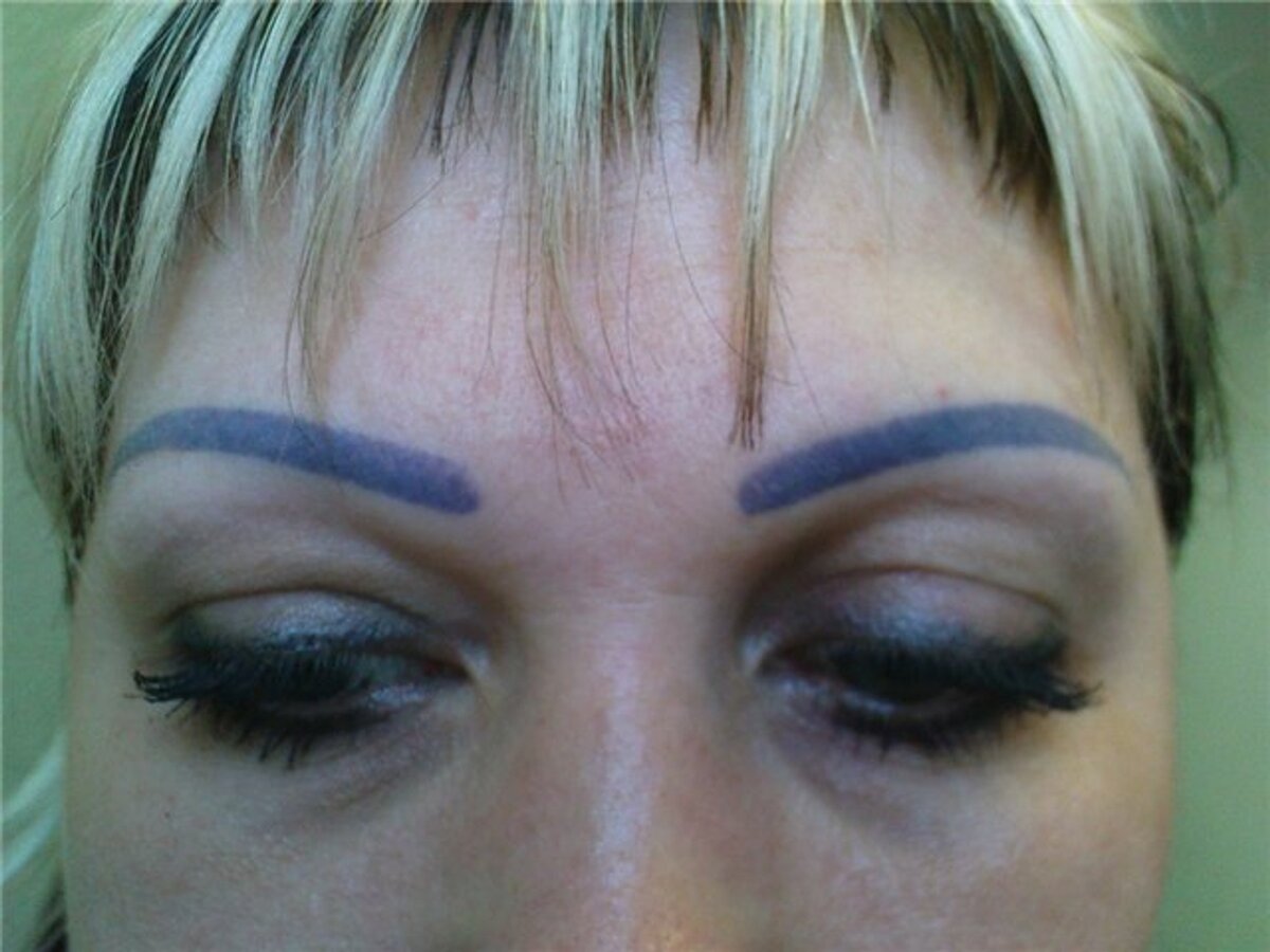    Посиневшие брови после неудачного татуажа. Фото: социальные сети