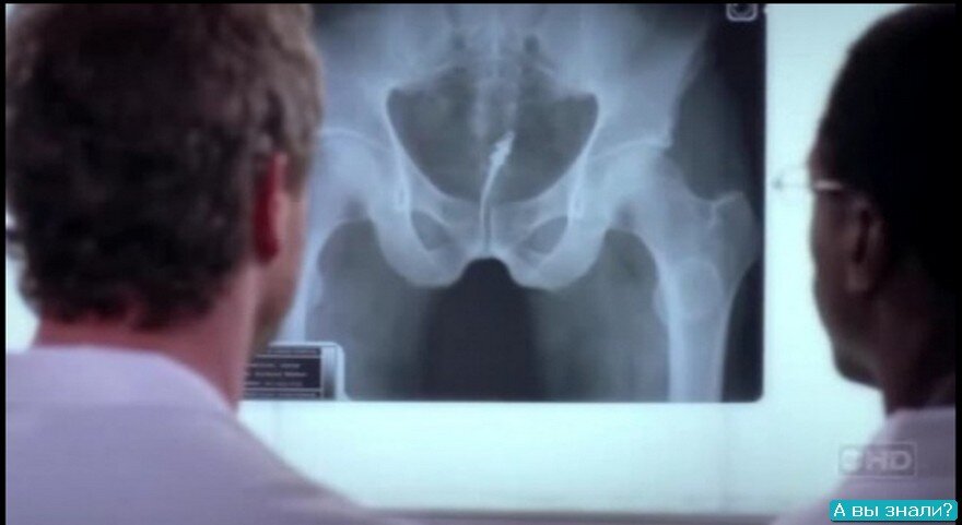 Кандиру. Снимок