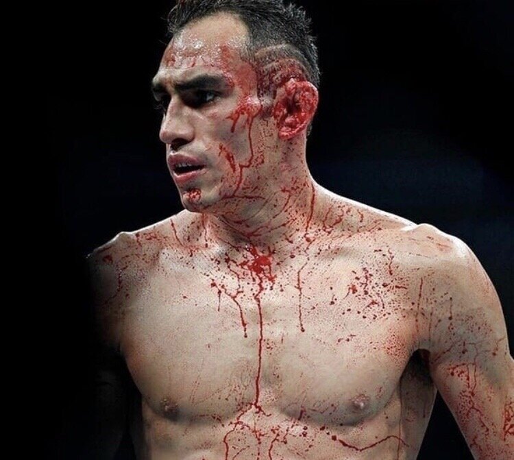 Всегда до крови 