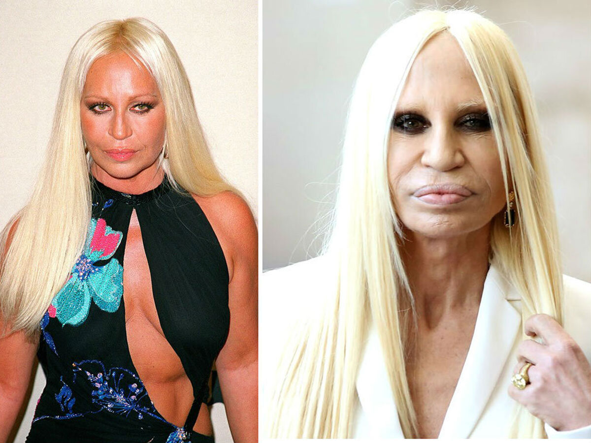 Жертва красоты. Донателла Версаче в молодости. Donatella Versace до пластики. Донателла Версаче 2020. Донателла Версаче в молодости до операций.