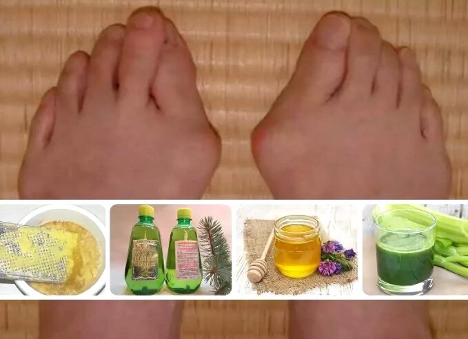 Источник фото: https://bezkostochki.ru/wp-content/uploads/2018/12/Narodnie_metodi.jpg