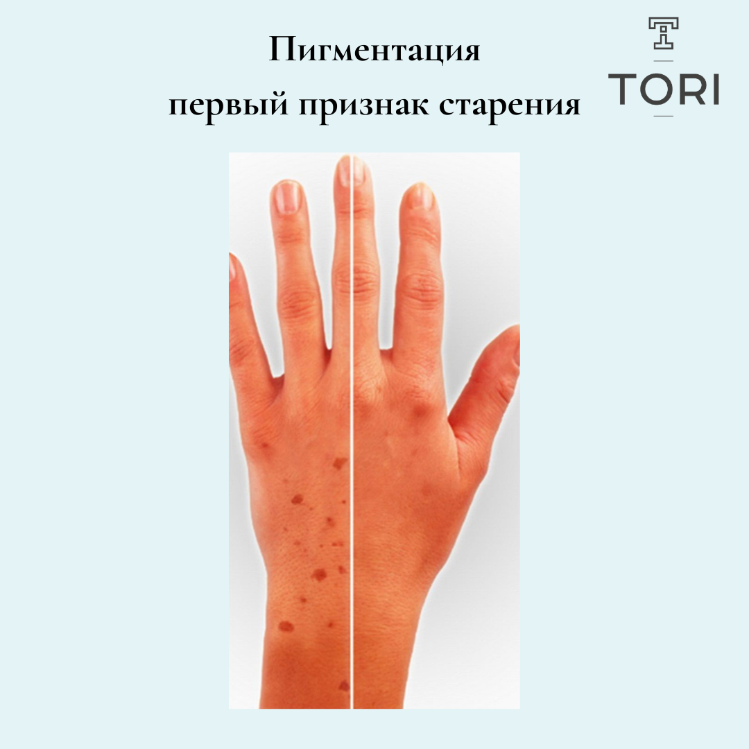 Регулярное увлажнение кожи рук