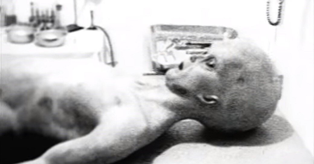 Пришелец на операционном столе