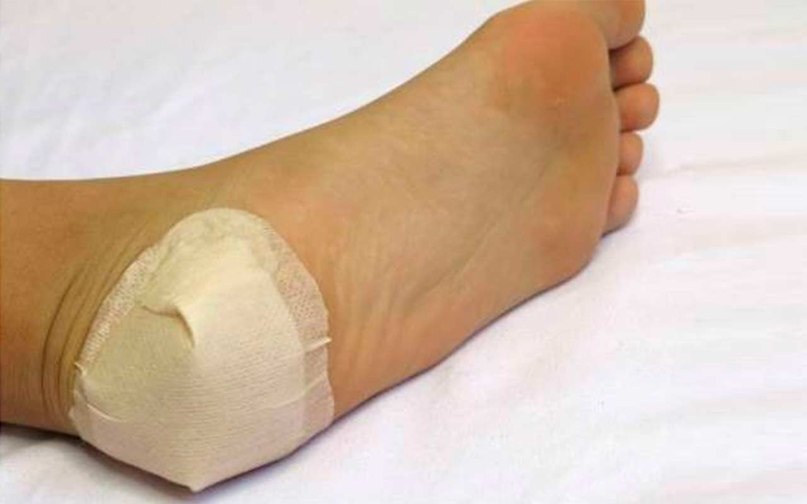 Это поможет избавиться от боли