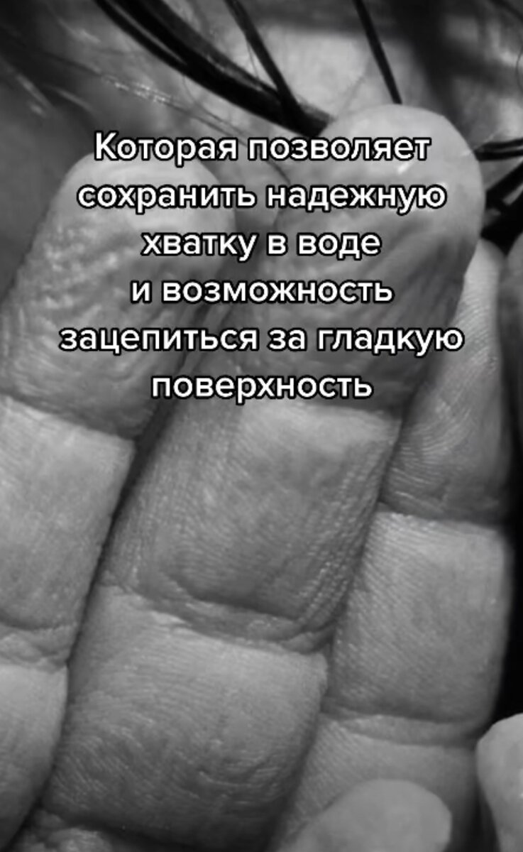 Норма или болезнь? Почему кожа на пальцах сморщивается после контакта с водой?