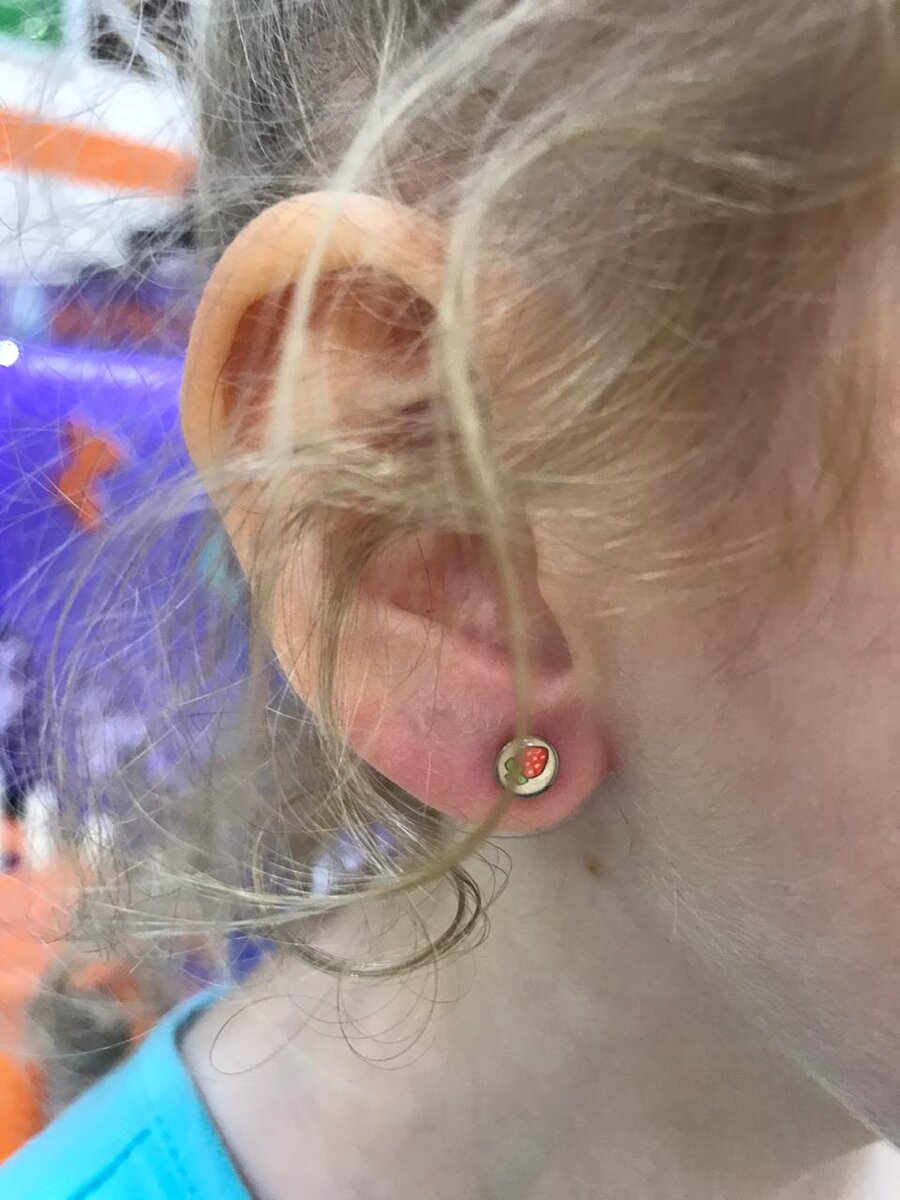 покраснение ушло очень быстро, как и говорил мастер