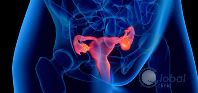 Нарушения в работе яичников могут возникнуть из-за другого заболевания или из-за психологического истощения. 