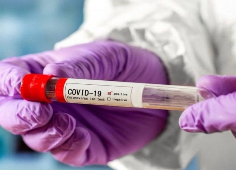 Тест на коронавирус. Источник: coronavirus-monitor.ru