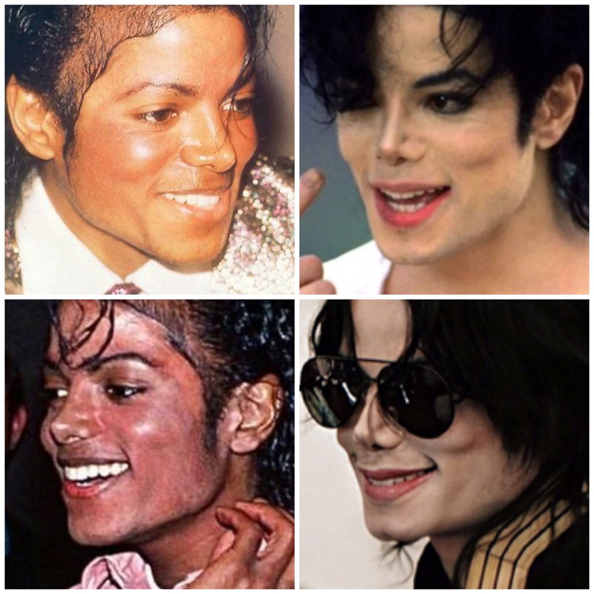 михаэль джексон до операции. майкл джексон до пластики. майкл джексон с белой кожей. майкл джексон эволюция внешности. майкл джексон операции.