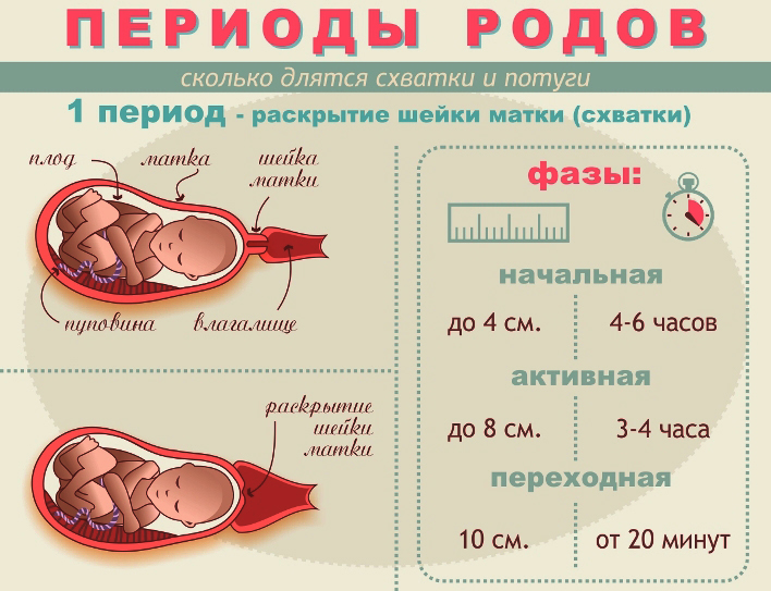 Предвестники родов