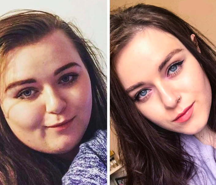 Очень сильно изменился. Лицо до и после похудения. Меняется лицо после похудения. Толстое лицо до и после. Лицо после похудения до и после.