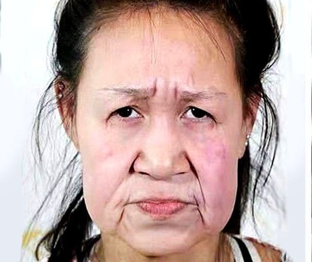 До пластики