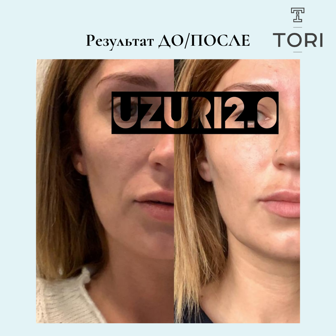 Результат ДО и ПОСЛЕ 