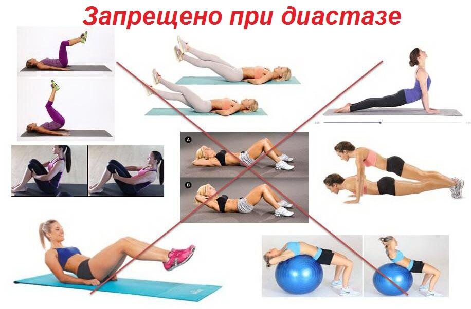 Фото с сайта https://plastiksurgery98.ru/