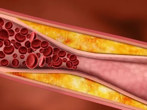 Фото из интернета