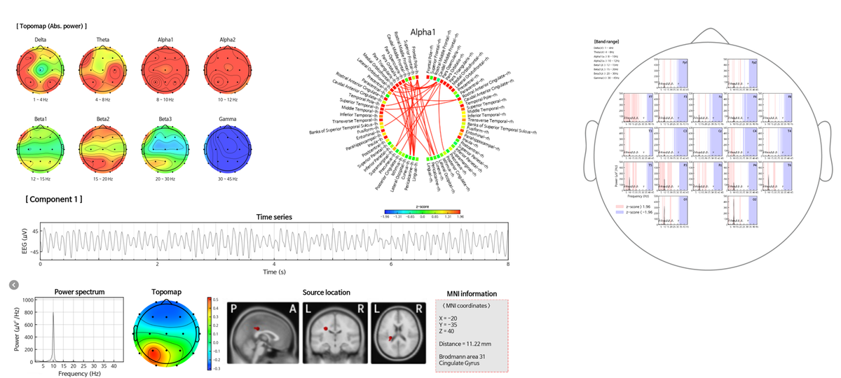 Результат анализа системы iSyncBrain