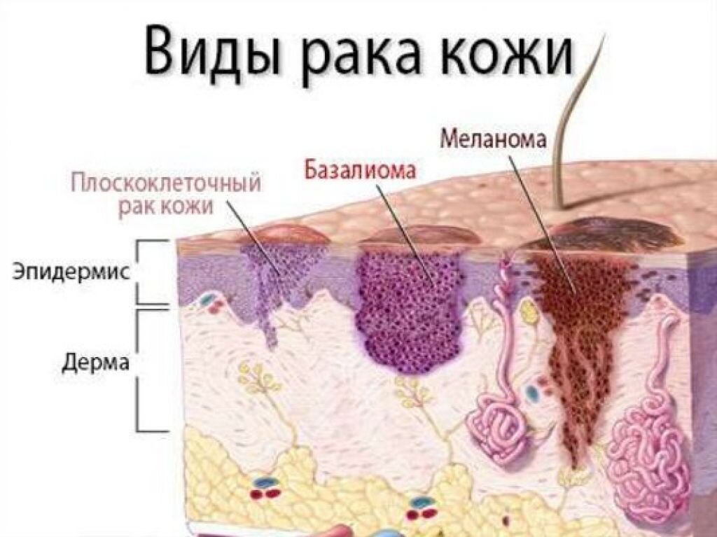 Как избежать тяжелых последствий после операции по удалению матки у женщин