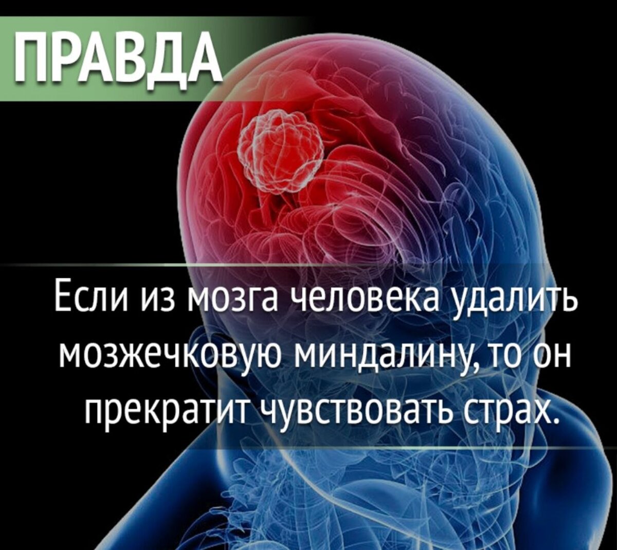 Ученые отключили миндалину в мозге живых обезьян