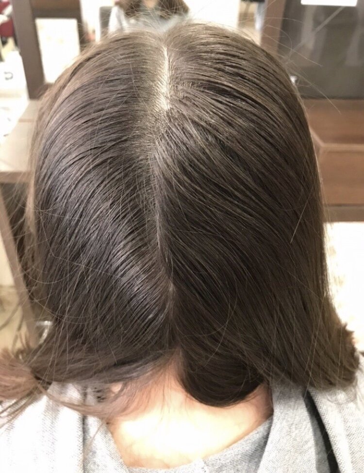 Волосы до мытья шампунем 