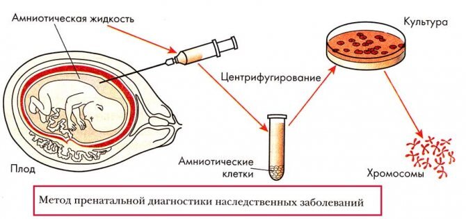 Генетические анализы